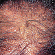 В очаге поражения волосы обламываются и выглядят в виде чёрных точек